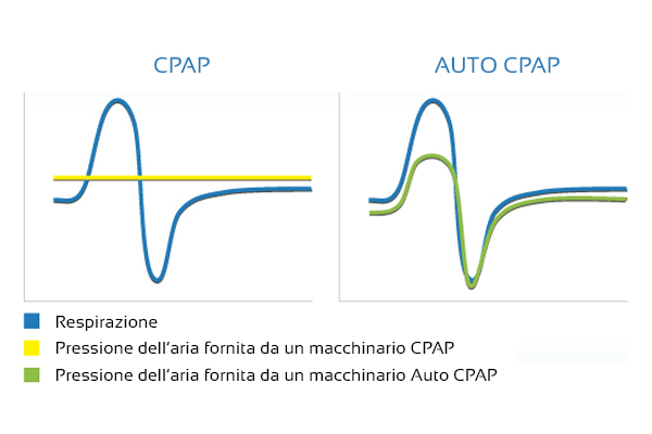 CPAP fissa VS auto